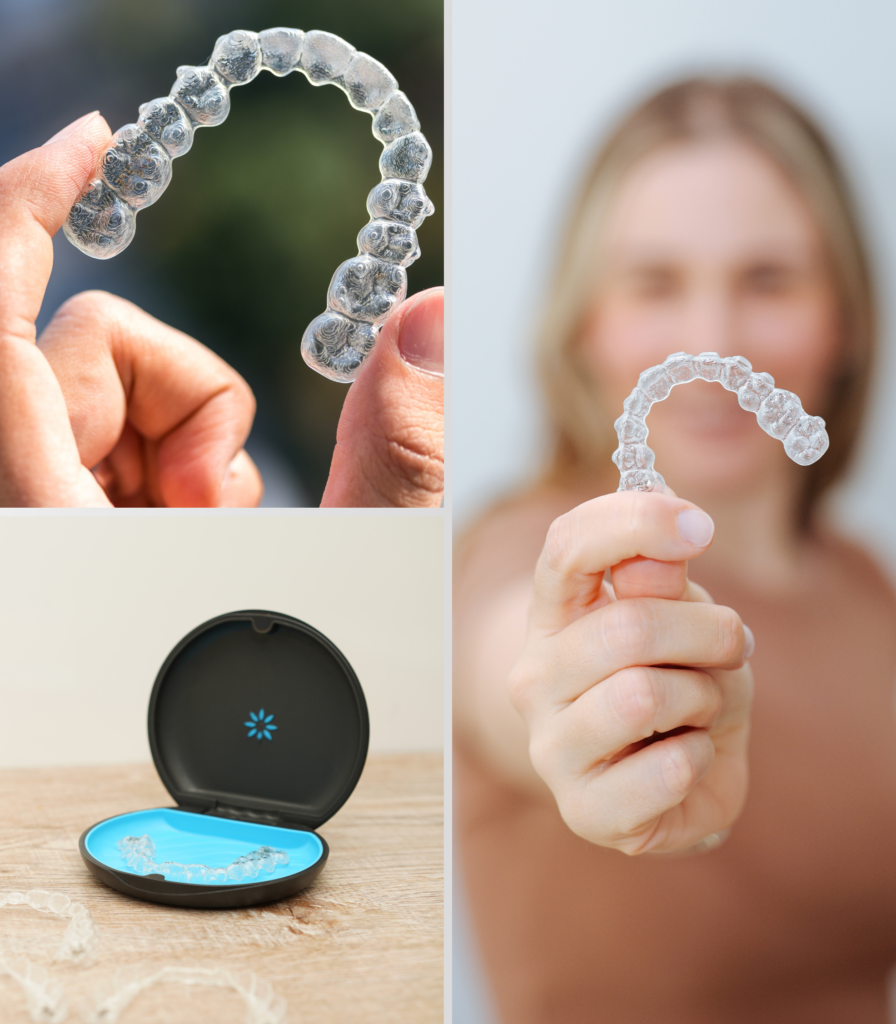 Alinhador invisível Invisalign na Ilha do Governador com planejamento digital