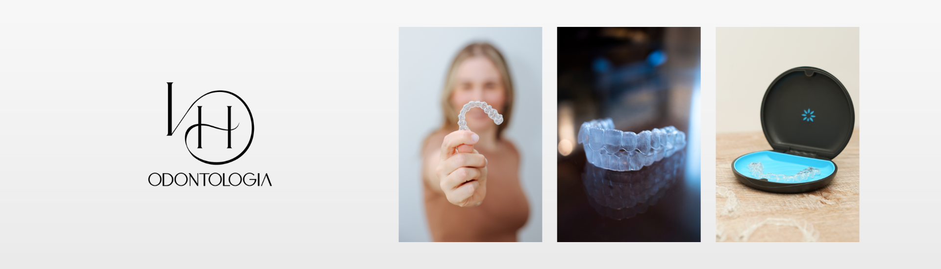 Alinhador invisível Invisalign na Ilha do Governador com planejamento digital