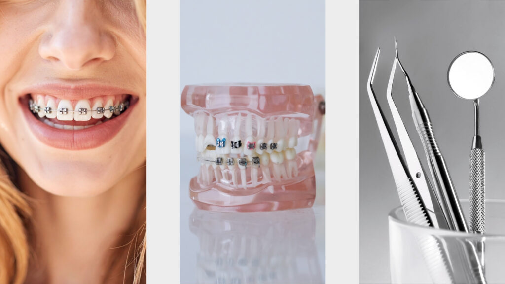 Alinhador invisível Invisalign na Ilha do Governador com planejamento digital