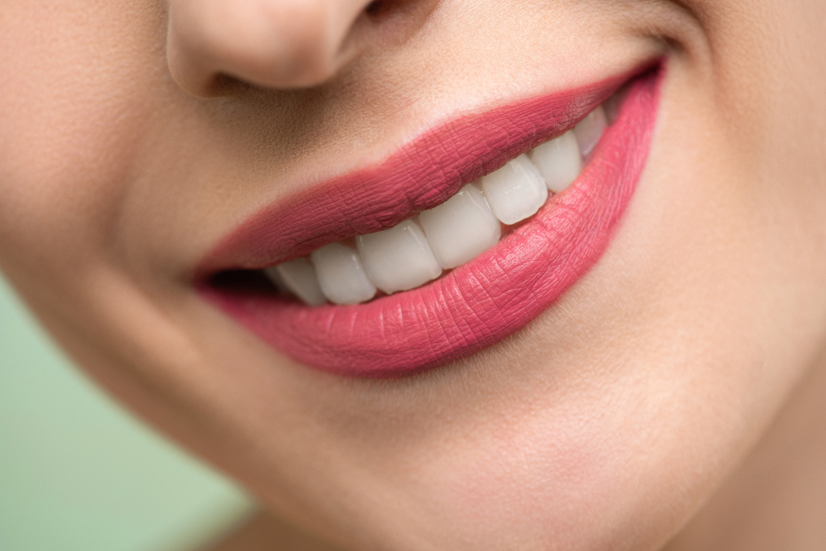 A estética dental é a chave para um sorriso harmonioso