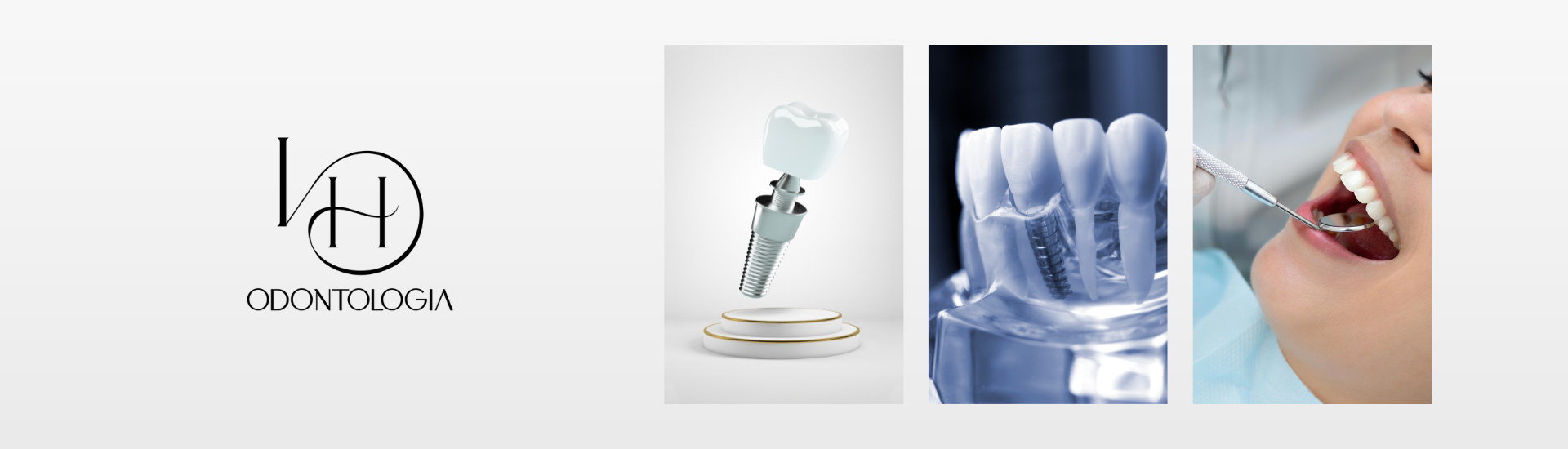 Planejamento digital de implante dentário em software odontológico 3D