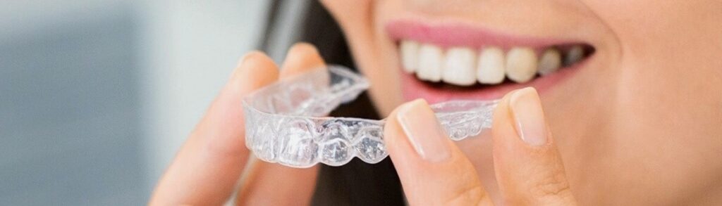 Alinhador invisível Invisalign na Ilha do Governador com planejamento digital
