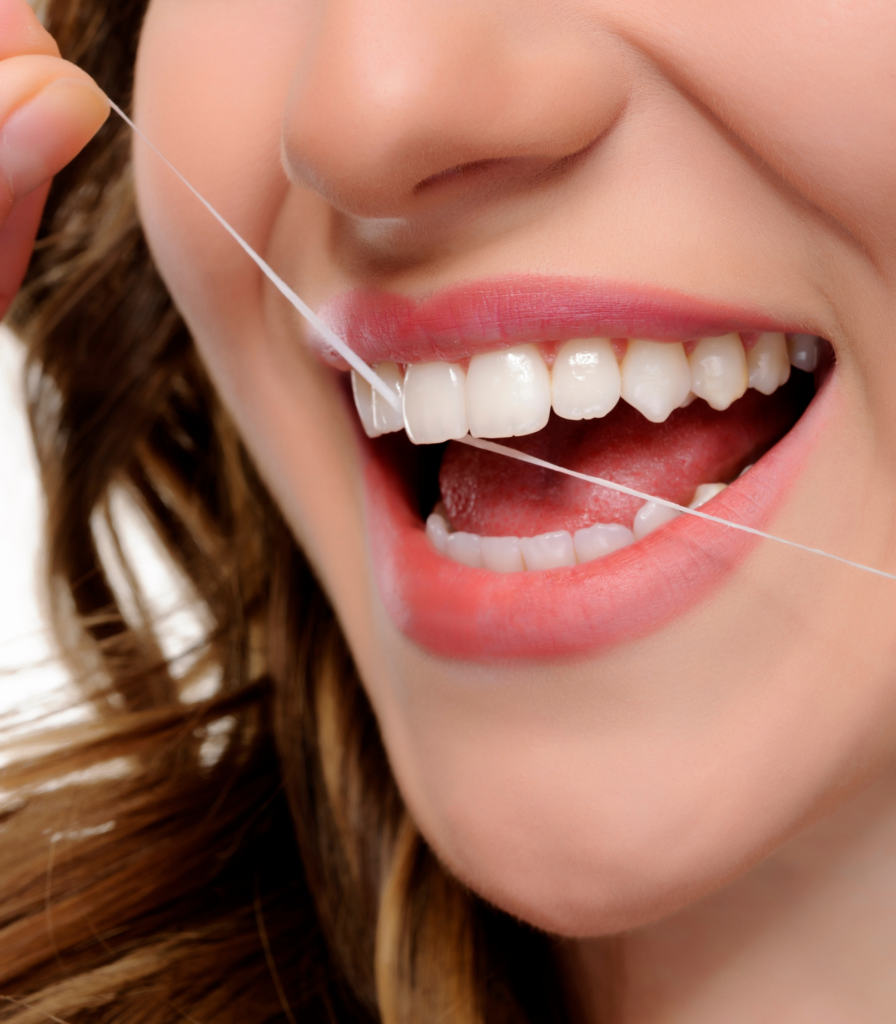 Uso do fio dental entre os dentes para remoção de placa bacteriana e prevenção de problemas gengivais