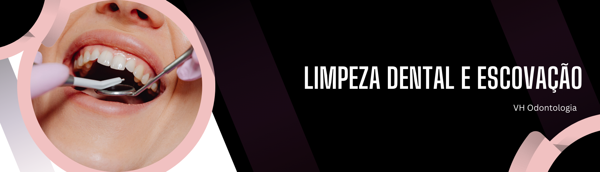 Limpeza dental profissional x escovação: por que você precisa das duas?