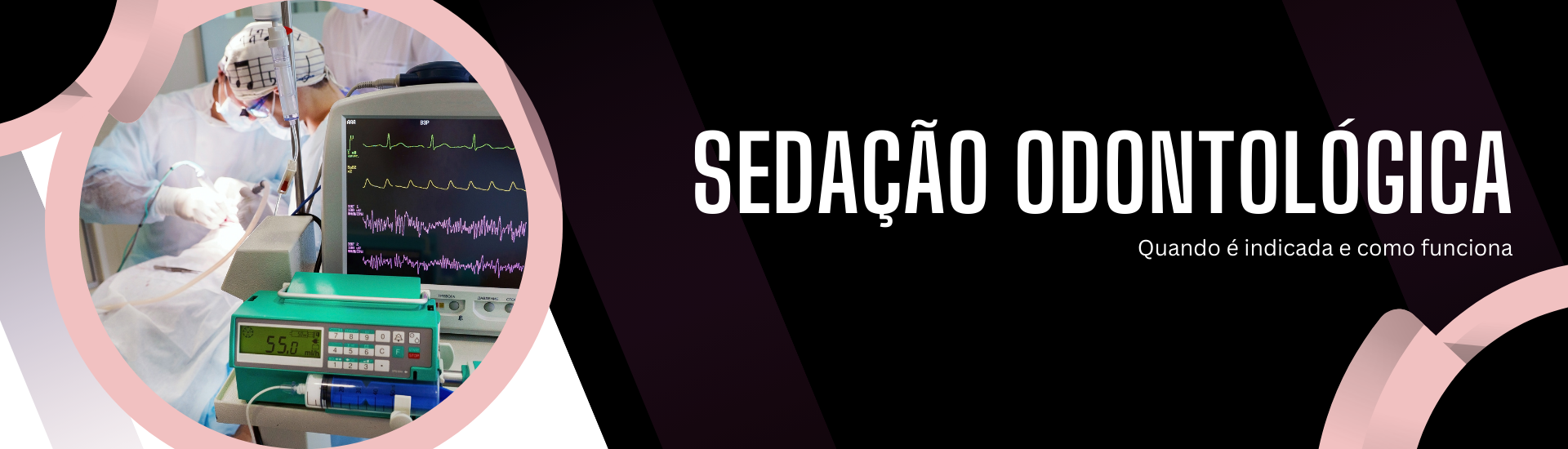 A sedação venosa é uma técnica moderna que proporciona tranquilidade e segurança durante procedimentos odontológicos. Indicada para pacientes ansiosos, com medo do dentista ou que precisam de tratamentos longos, ela garante relaxamento profundo sem perder a consciência. Na VH Odontologia, todo o processo é realizado por anestesista especializado, com monitoramento completo e atenção ao bem-estar do paciente.